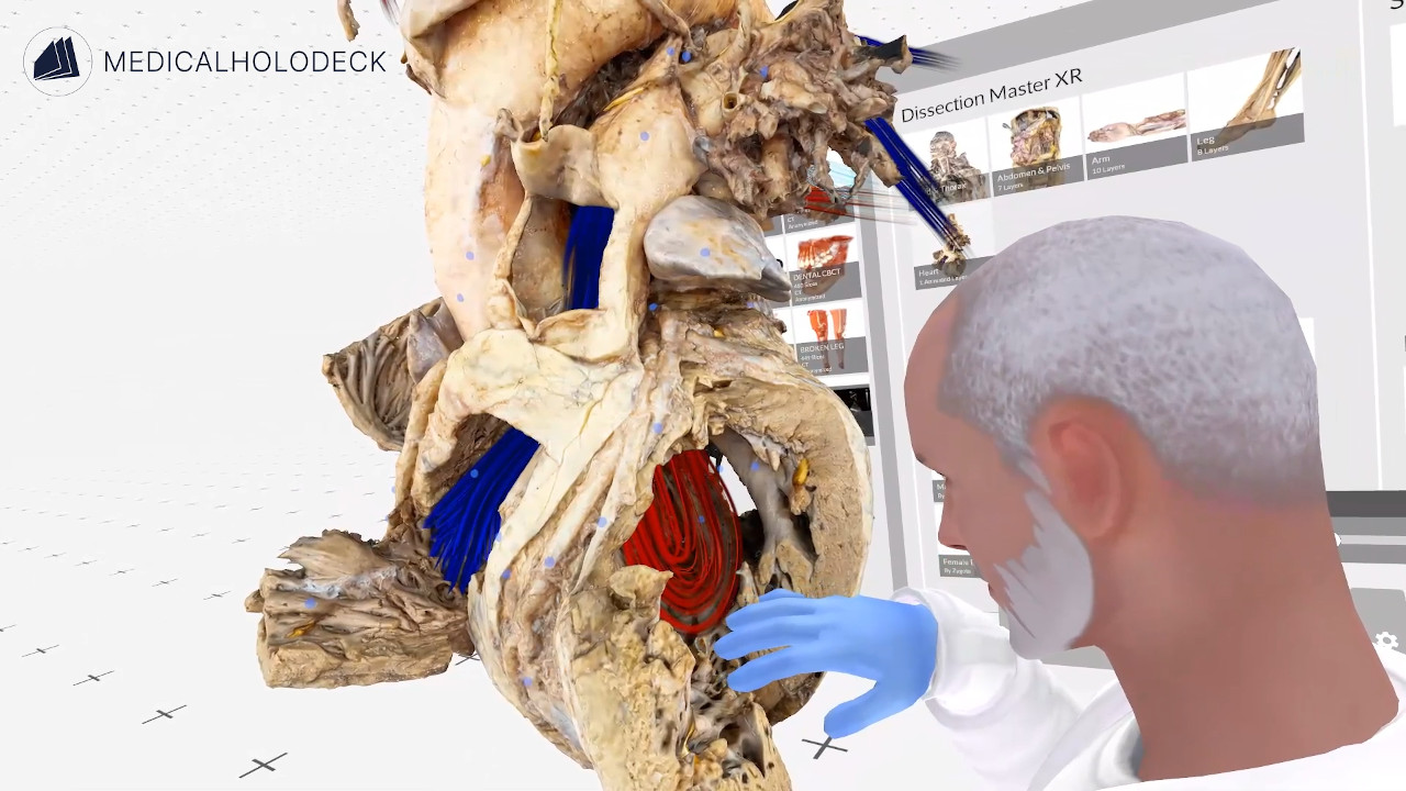 The blood flow through the heart thumbnail 5