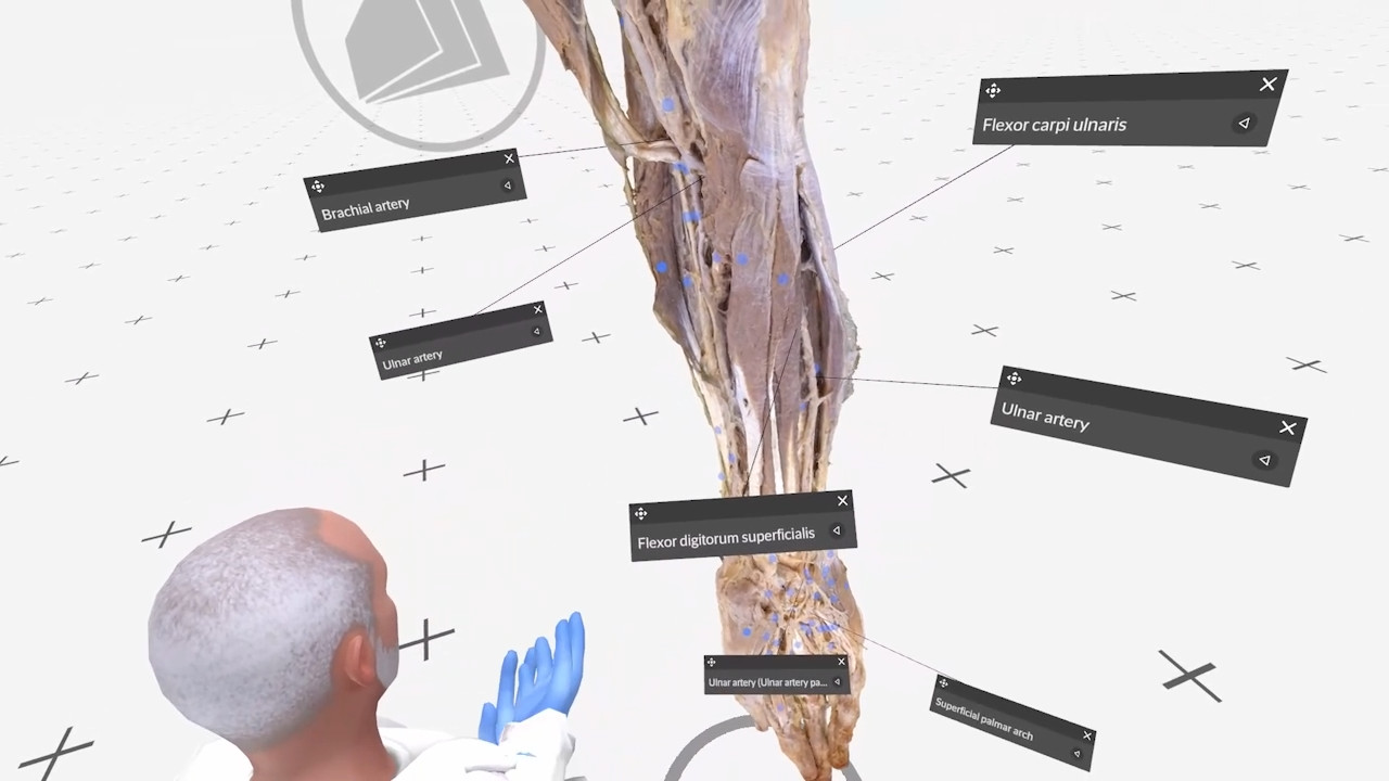 The ulnar artery thumbnail 3