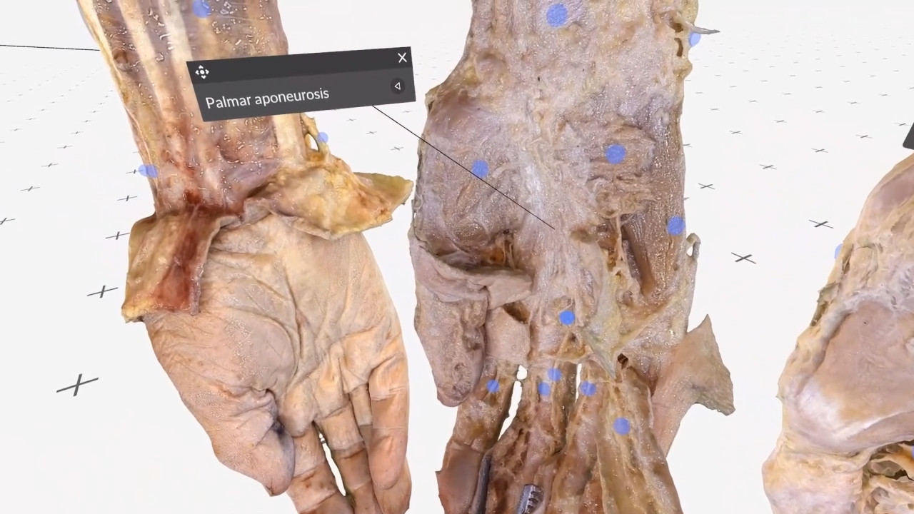 The hand thumbnail 2