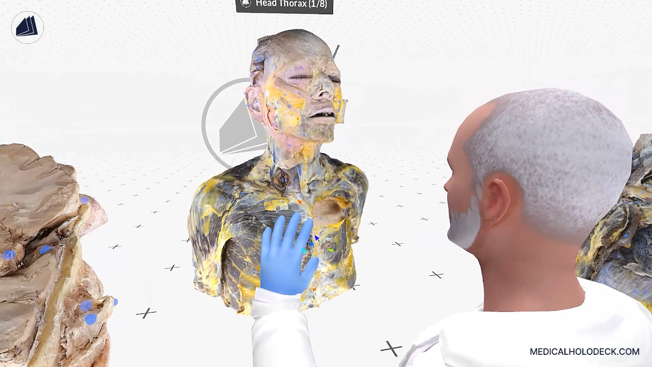 The head and thorax thumbnail 1