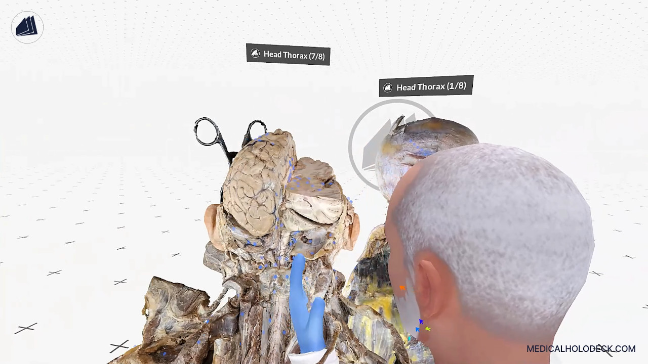 The head and thorax thumbnail 4