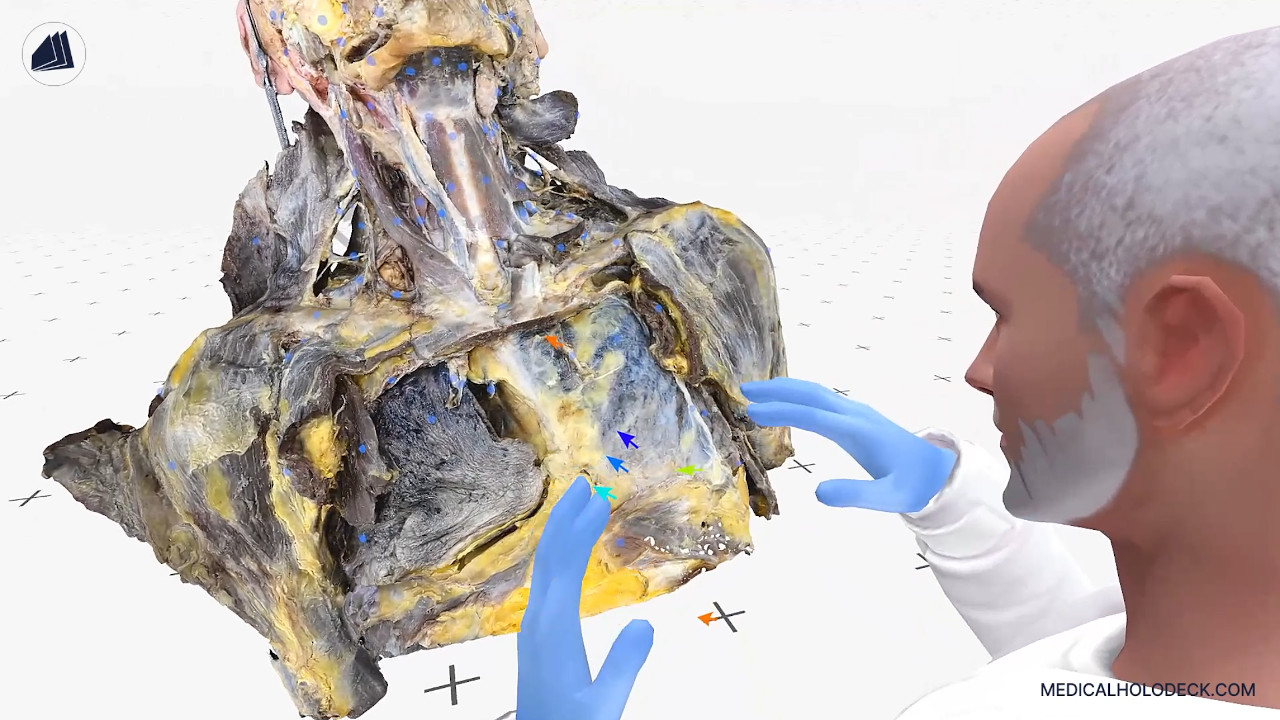 The head and thorax thumbnail 3