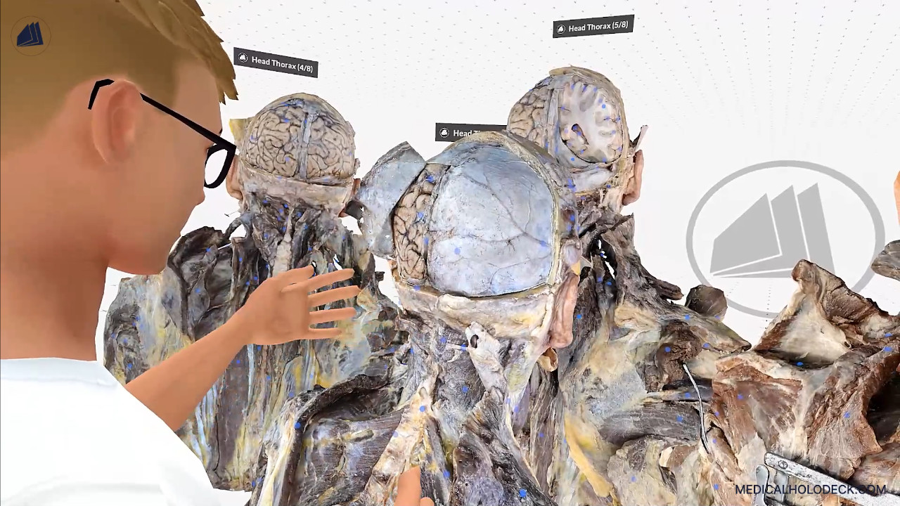 A journey through the human brain thumbnail 5