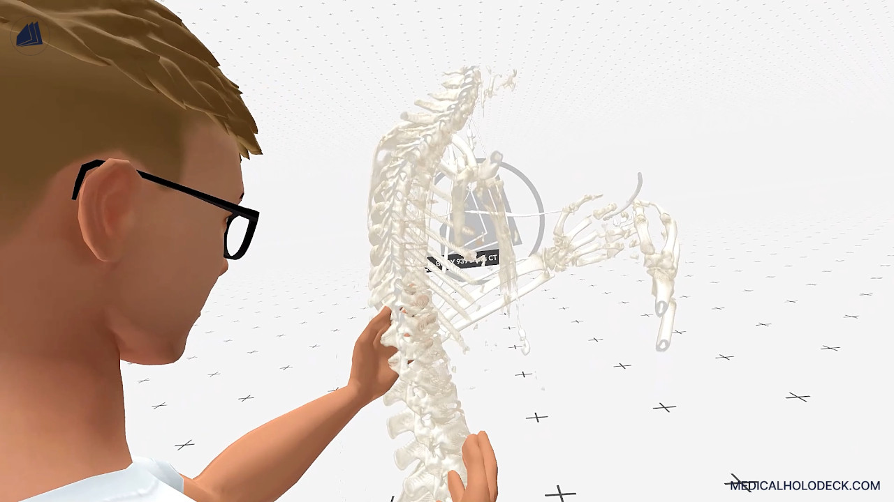 The anatomy of the spine thumbnail 2