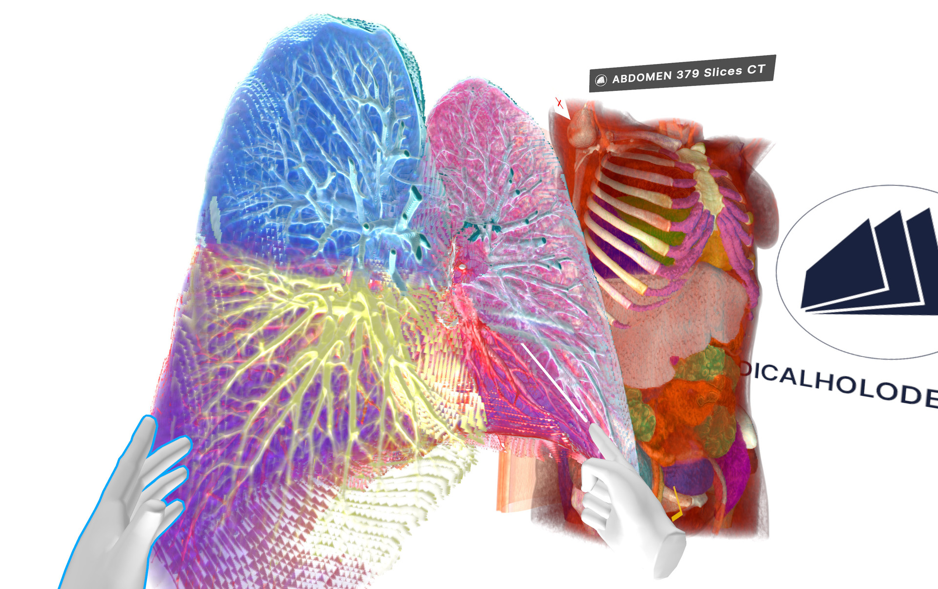 Introducing Medicalholodeck AI