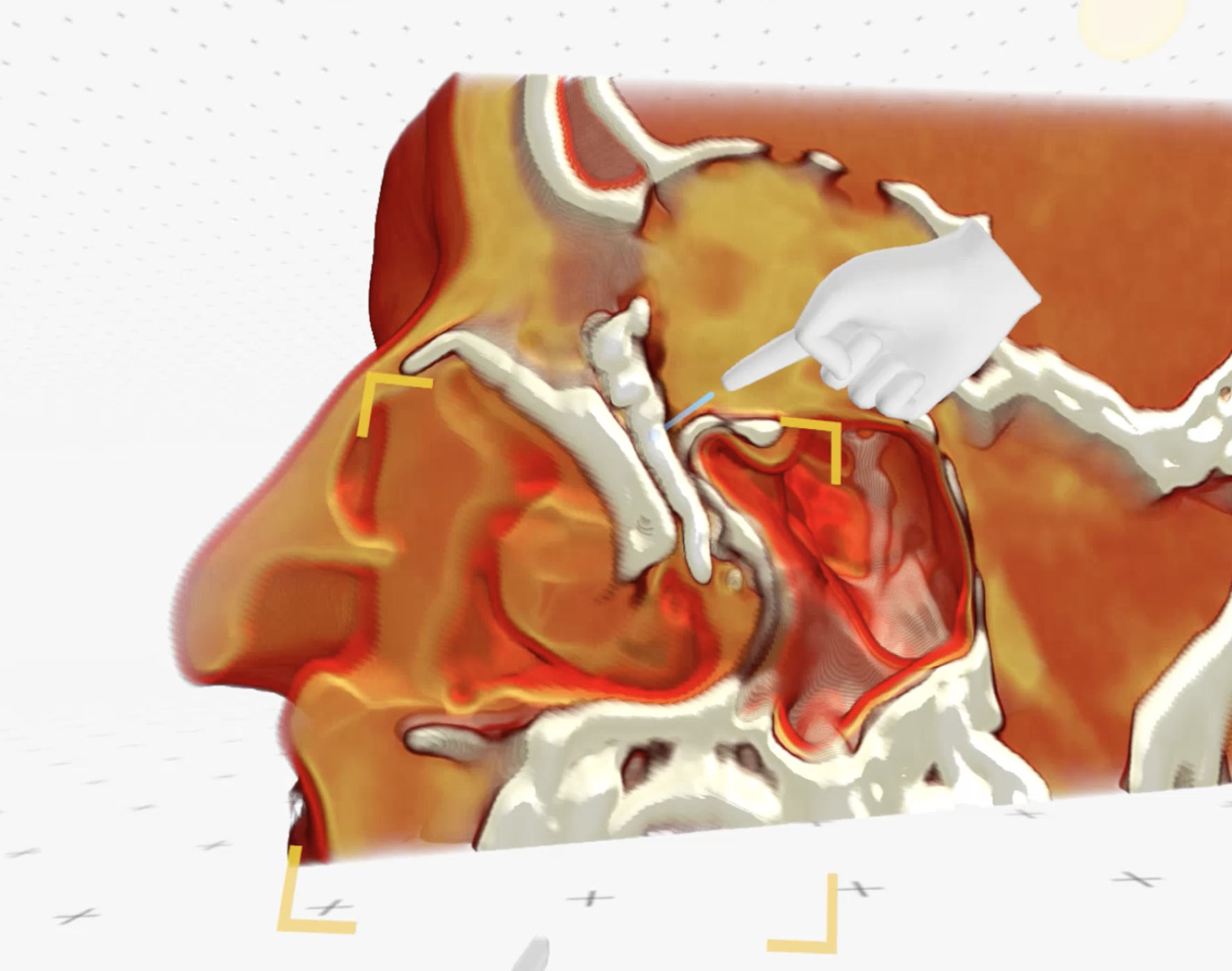 Article Header Image