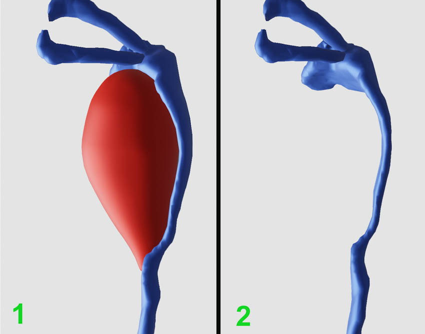 Article Header Image