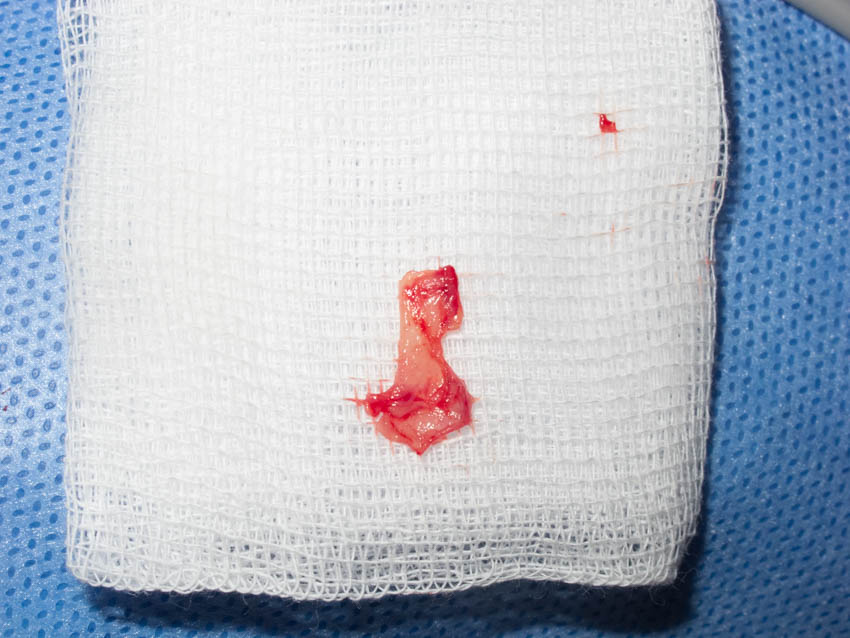 Article Header Image