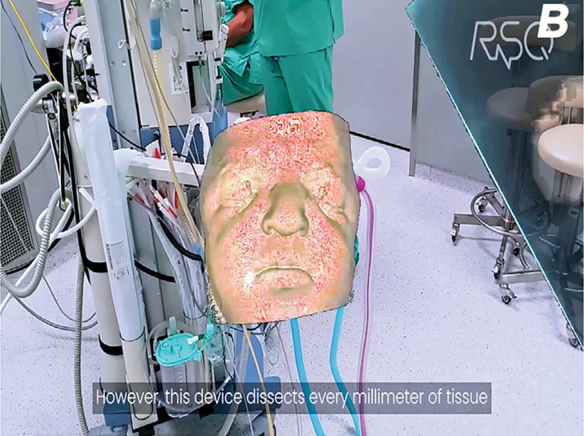 Spatial imaging in endoscopic DCR: the emergence of virtual and mixed reality technologies