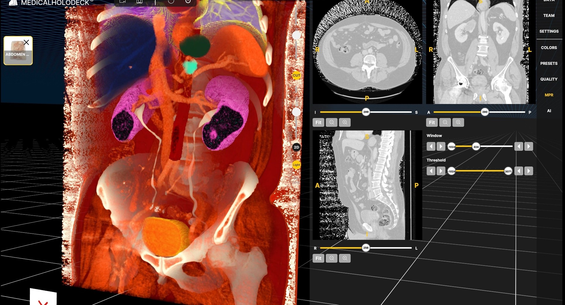 Medicalholodeck at DRUS 2025 in Hamburg