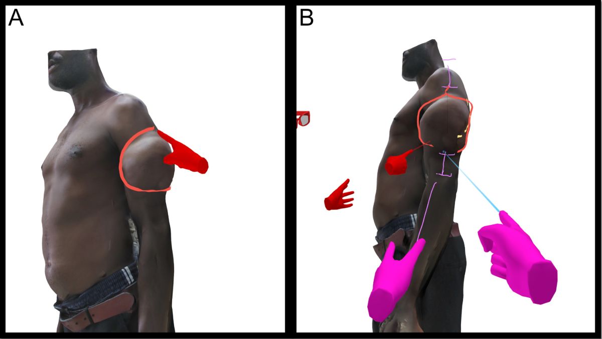 Collaborative VR in reconstructive surgery
