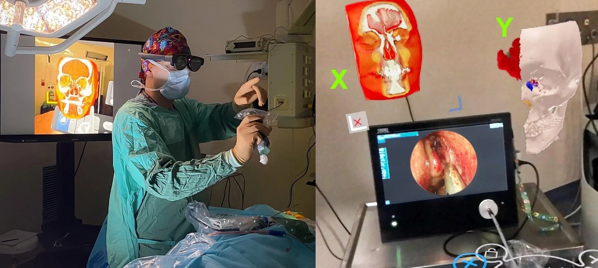 Mixed reality in intraoperative use