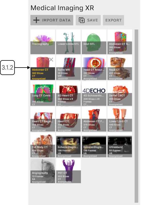 Running AI segmentation