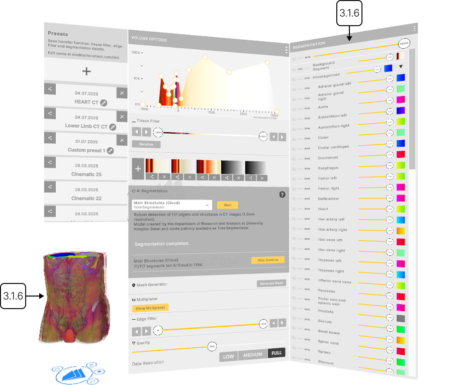Running AI segmentation